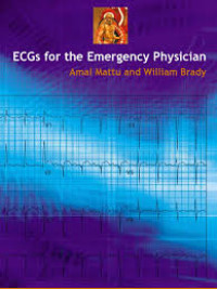 Image of ECGs for the Emergency Physician